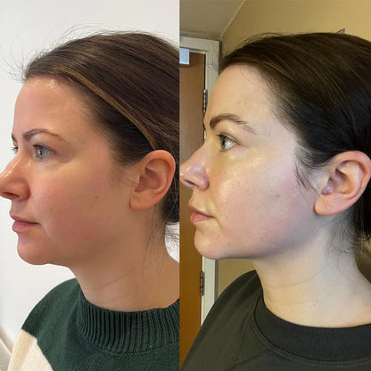 Drop the Puffiness. Feel the Difference—Naturally