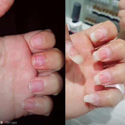 Repair, Restore & Regrow Your Nails - Naturally