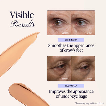 Take Years Off the Look of Your Eyes—Instantly