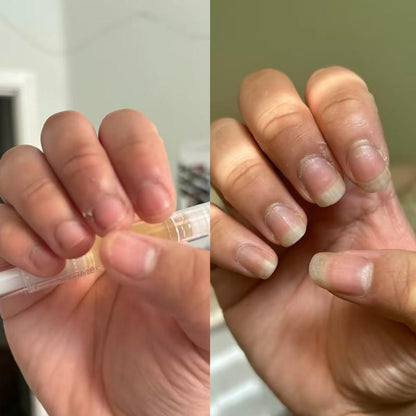 Repair, Restore & Regrow Your Nails - Naturally