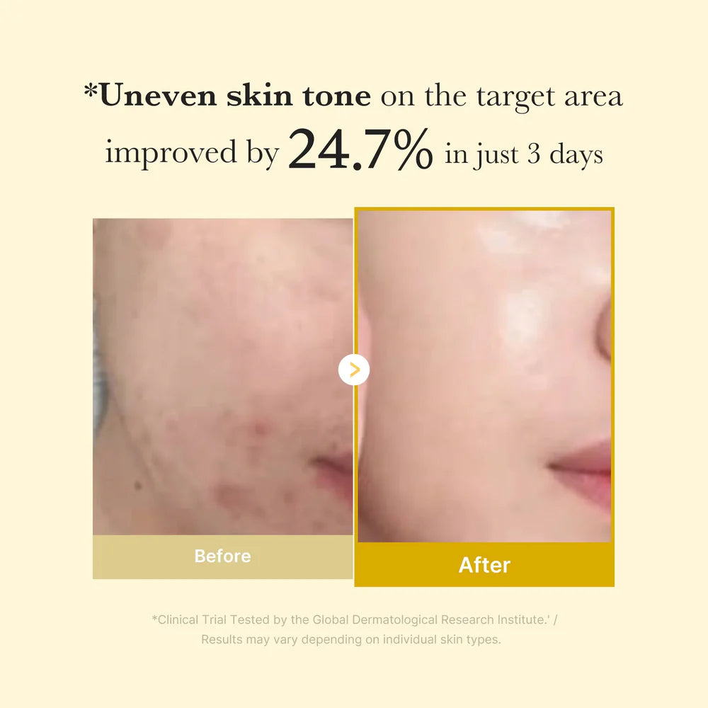 Brighten, Smooth, and Glow — All Overnight