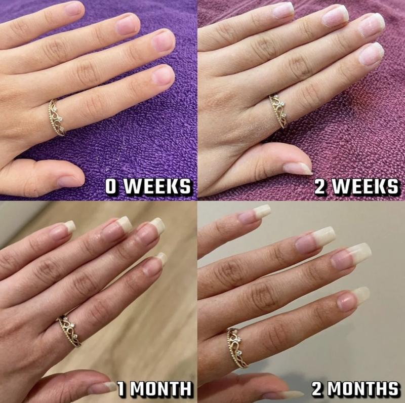 Repair, Restore & Regrow Your Nails - Naturally