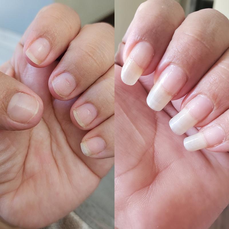 Repair, Restore & Regrow Your Nails - Naturally