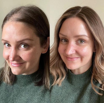Reverse Thinning Hair & Restore Thickness - Naturally