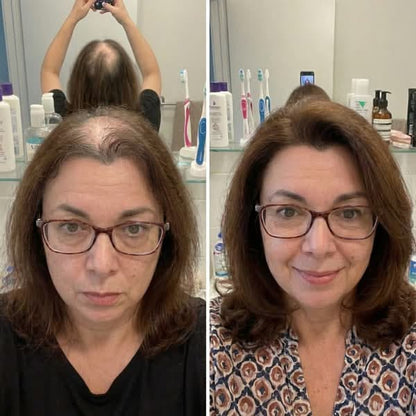 Reverse Thinning Hair & Restore Thickness - Naturally