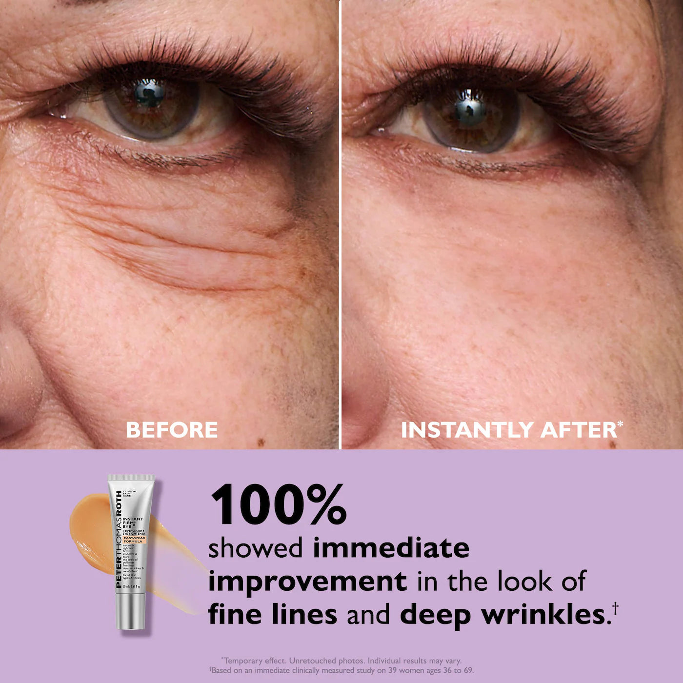 TIGHTEN YEARS OFF YOUR EYES—INSTANTLY