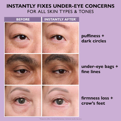 TIGHTEN YEARS OFF YOUR EYES—INSTANTLY